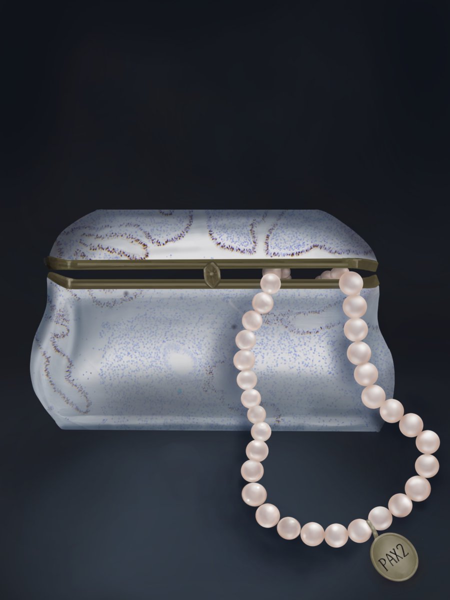 Ram_Mani_PhD's tweet image. The pearl necklace model of transcriptional silencing—developed in collaboration with Diego Castrillon’s team—explains a phenomenon observed in > 80% of human endometrial cancers. The study is now published in a peer reviewed journal. jci.org/articles/view/…