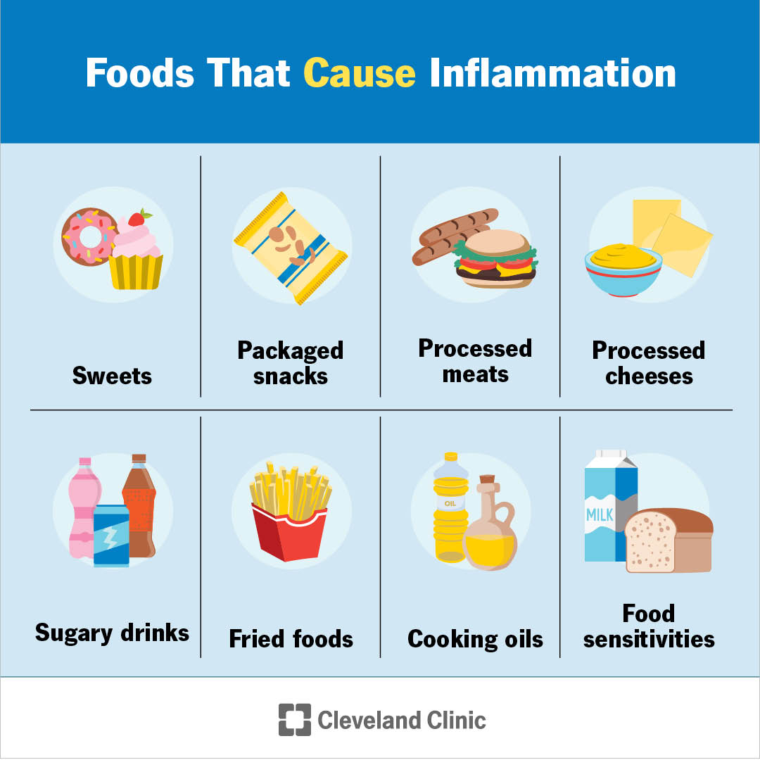 The foods you eat (and the ones you avoid) can help soothe and even prevent inflammation by quashing your body’s inflammatory responses. But because everyone’s inflammatory triggers are different, there’s no one-size-fits-all anti-inflammatory diet.