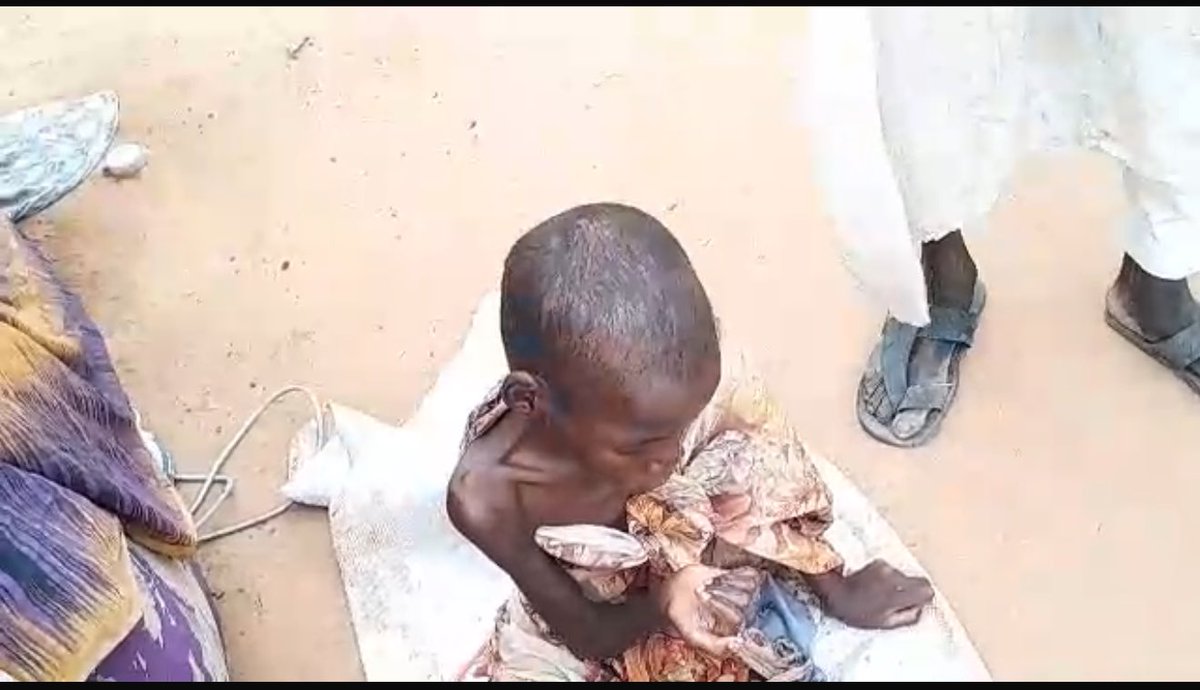 This little boy has eaten nothing but animal fodder, and sometimes goes for days without any food.
This has led him to reach the most severe stage of malnutrition — level five 
Please donate, as there are many like him in El Fasher, West Sudan

paypal.com/donate/?hosted…