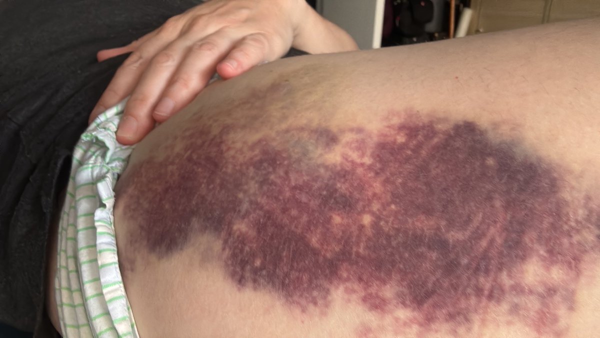 Andrea Filip tweet media