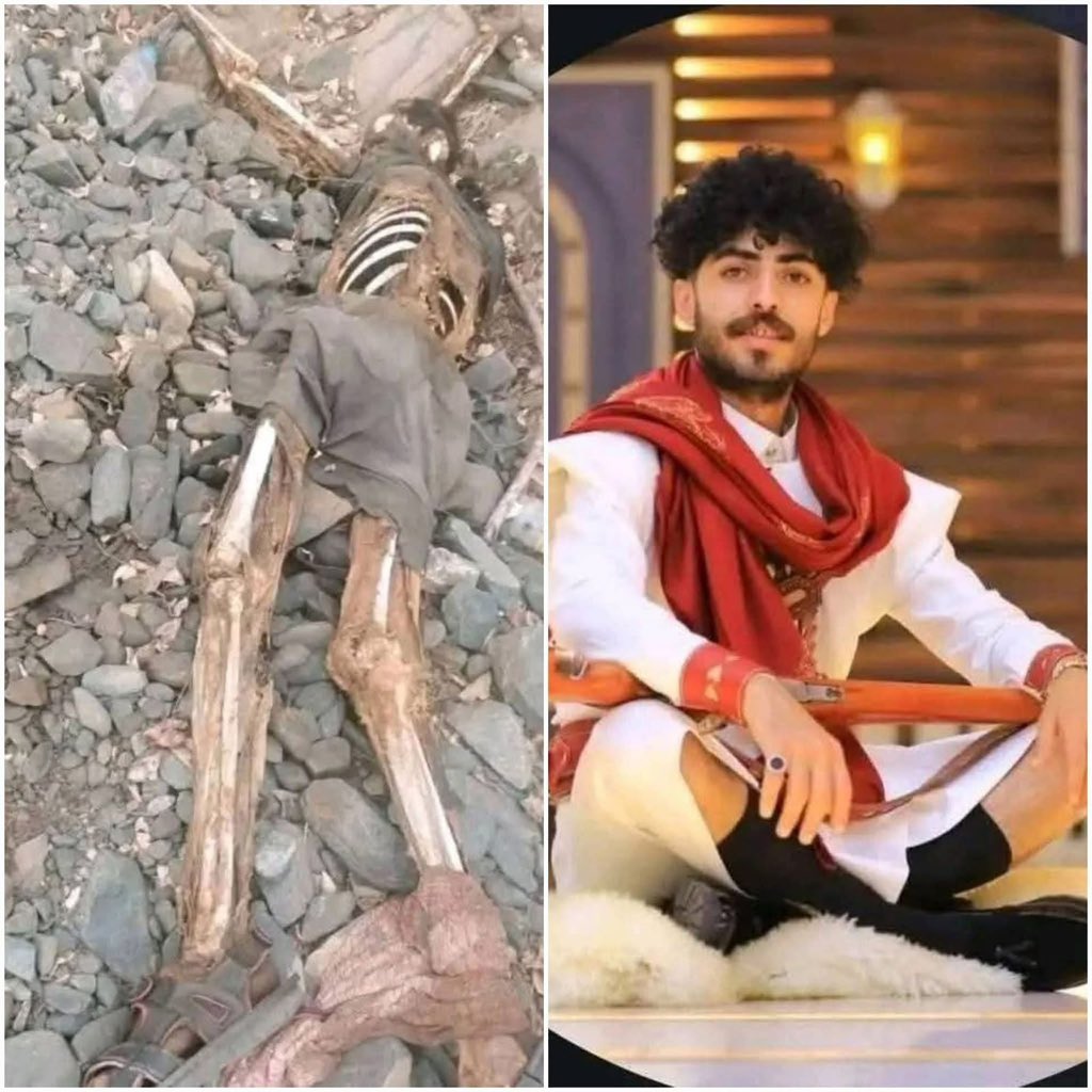 لاعب كرة القدم في نادي شعب إب  النجم خالد الجبري عثر عليه في الحدود  اليمنية السعودية بهذه الحالة  بعد خروجة من  منزلة قبل 3 أشهر طلباً للرزق ولقمة العيش . 
الله يرحمه ويغفر له ويسكنه فسيح جناته  ولا حولا ولا قوة الا بالله العلي العظيم