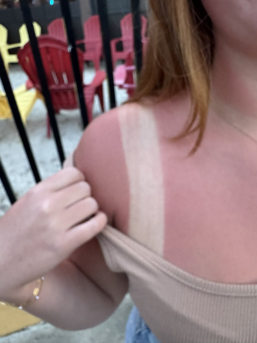 “I’m not that burnt”