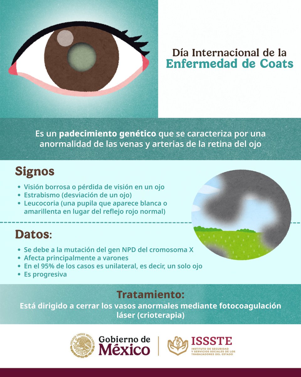 Que nos echen un ojito en los ojitos, nunca había sido tan necesario. 😉

👁️ La enfermedad de #Coats se manifiesta desde que estamos peques y si no se diagnostica de manera oportuna, nos puede ocasionar pérdida de visión.

Pero no te alarmes, solo se registran en promedio 200