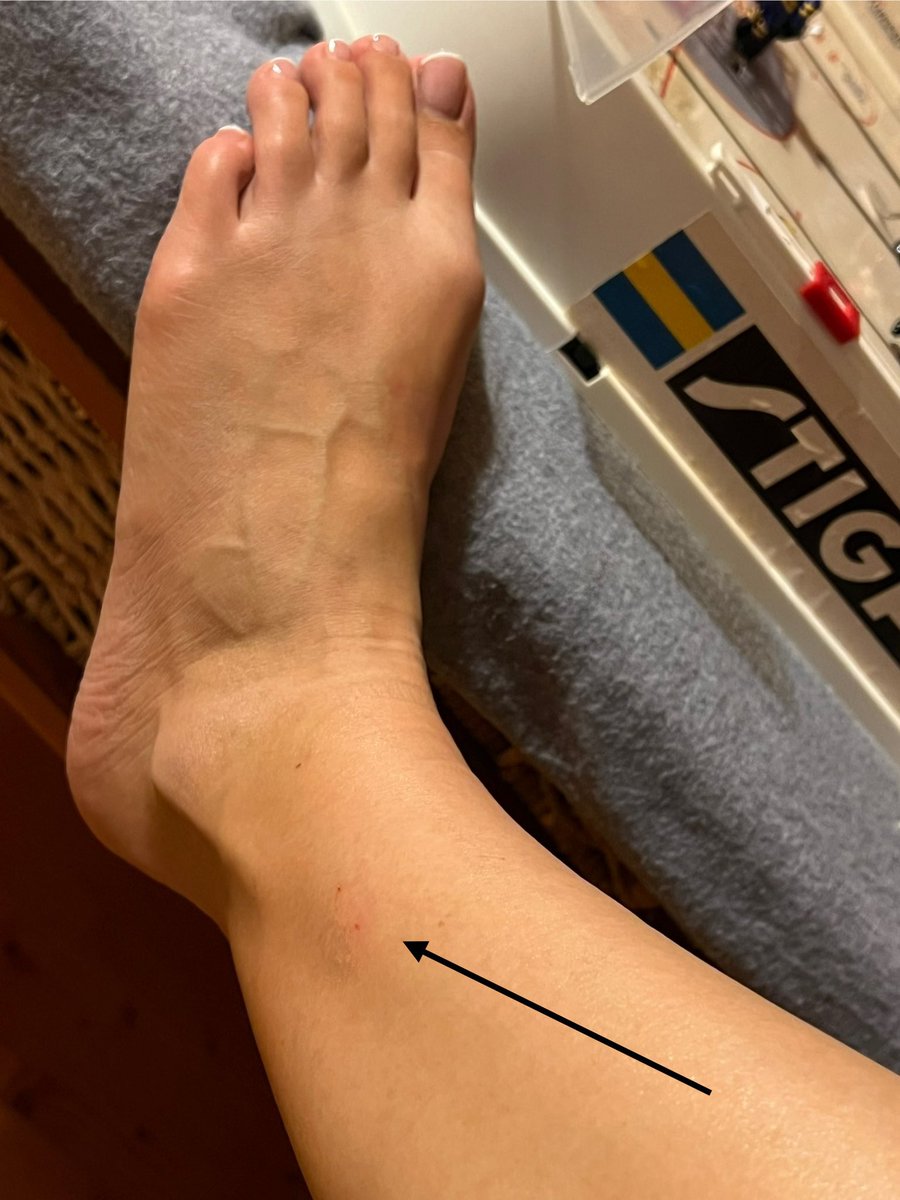 🐍 Visiting relatives is definitely dangerous! 😅