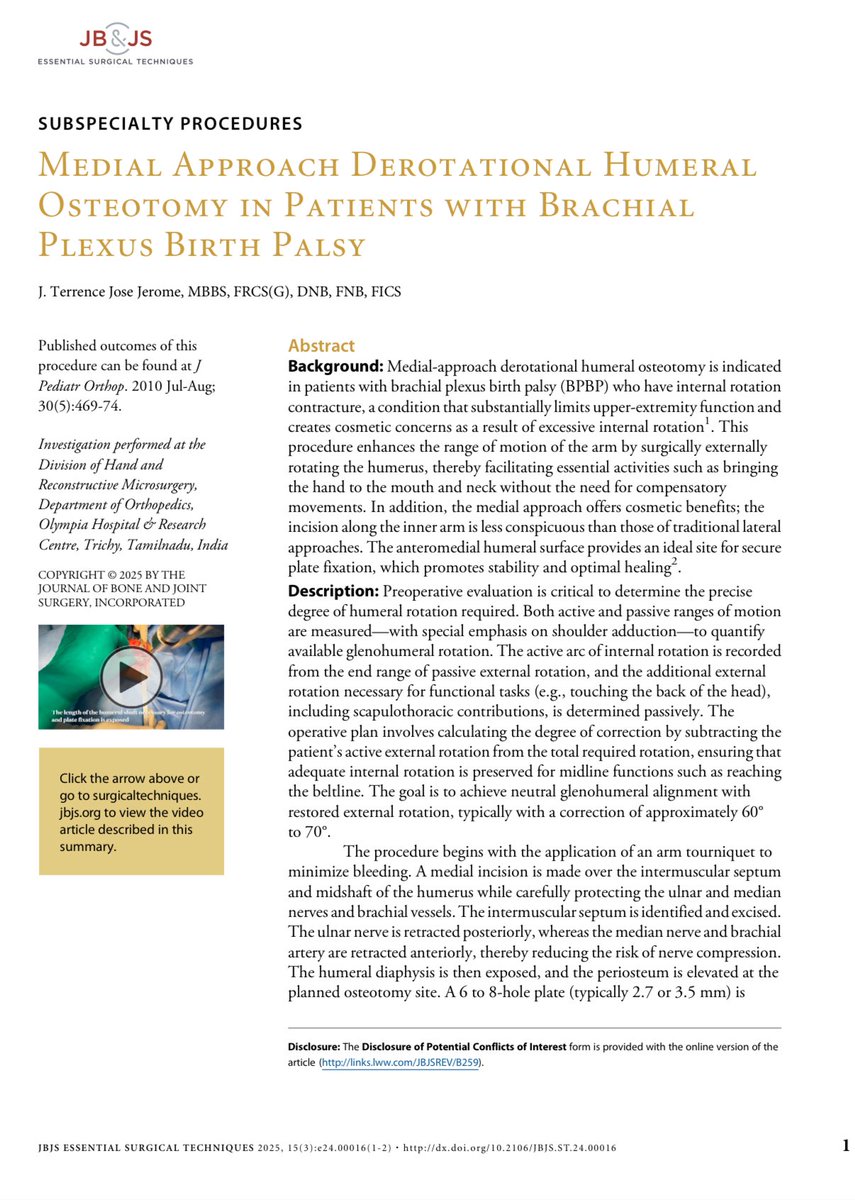 Terrence Jose Jerome, FRCS (@terrencejose) on Twitter photo Article in JBJS
Medial Approach Derotational Humeral Osteotomy for brachial plexus birth palsy – improving function & cosmesis in older children/adolescents.
journals.lww.com/jbjsest/abstra… <a href="/jbjs/">J Bone & Joint Surg</a> <a href="/JHSEur/">The Journal of Hand Surgery (European Volume)</a> <a href="/JHandSurg/">J Hand Surg Am- ASSH</a> <a href="/BSSHand/">British Society for Surgery of the Hand</a> <a href="/prsjournal/">Plastic and Reconstructive Surgery</a> <a href="/PRSGlobalOpen/">PRS Global Open</a> <a href="/AAOS1/">AAOS</a> <a href="/BoneJointJ/">The Bone & Joint Journal</a> <a href="/HandSurgeryAssn/">AAHS</a> Article in JBJS
Medial Approach Derotational Humeral Osteotomy for brachial plexus birth palsy – improving function & cosmesis in older children/adolescents.
journals.lww.com/jbjsest/abstra… <a href="/jbjs/">J Bone & Joint Surg</a> <a href="/JHSEur/">The Journal of Hand Surgery (European Volume)</a> <a href="/JHandSurg/">J Hand Surg Am- ASSH</a> <a href="/BSSHand/">British Society for Surgery of the Hand</a> <a href="/prsjournal/">Plastic and Reconstructive Surgery</a> <a href="/PRSGlobalOpen/">PRS Global Open</a> <a href="/AAOS1/">AAOS</a> <a href="/BoneJointJ/">The Bone & Joint Journal</a> <a href="/HandSurgeryAssn/">AAHS</a>