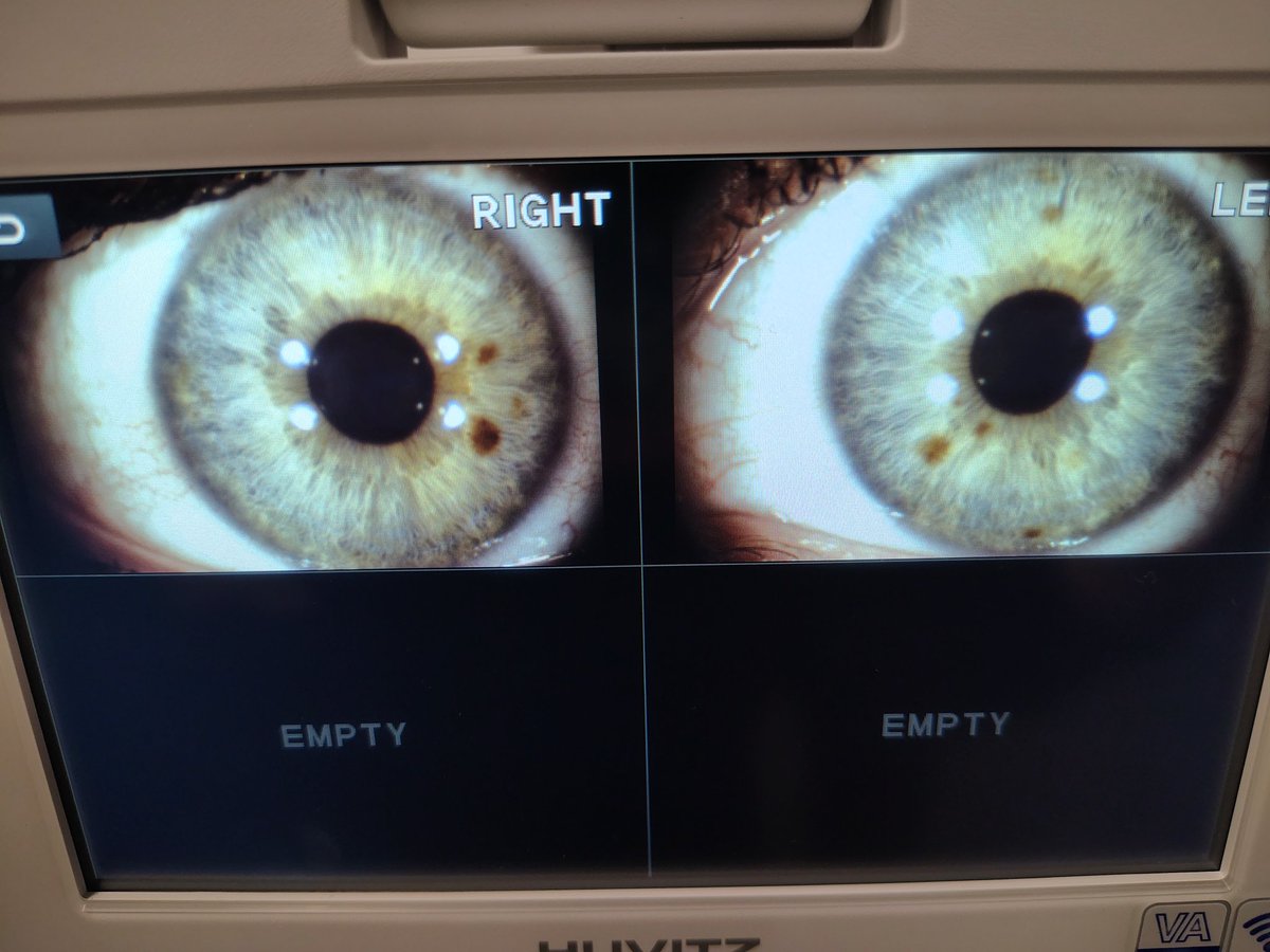 _GamingSam's tweet image. We got a new instrument at work. Enjoy my eyeballs