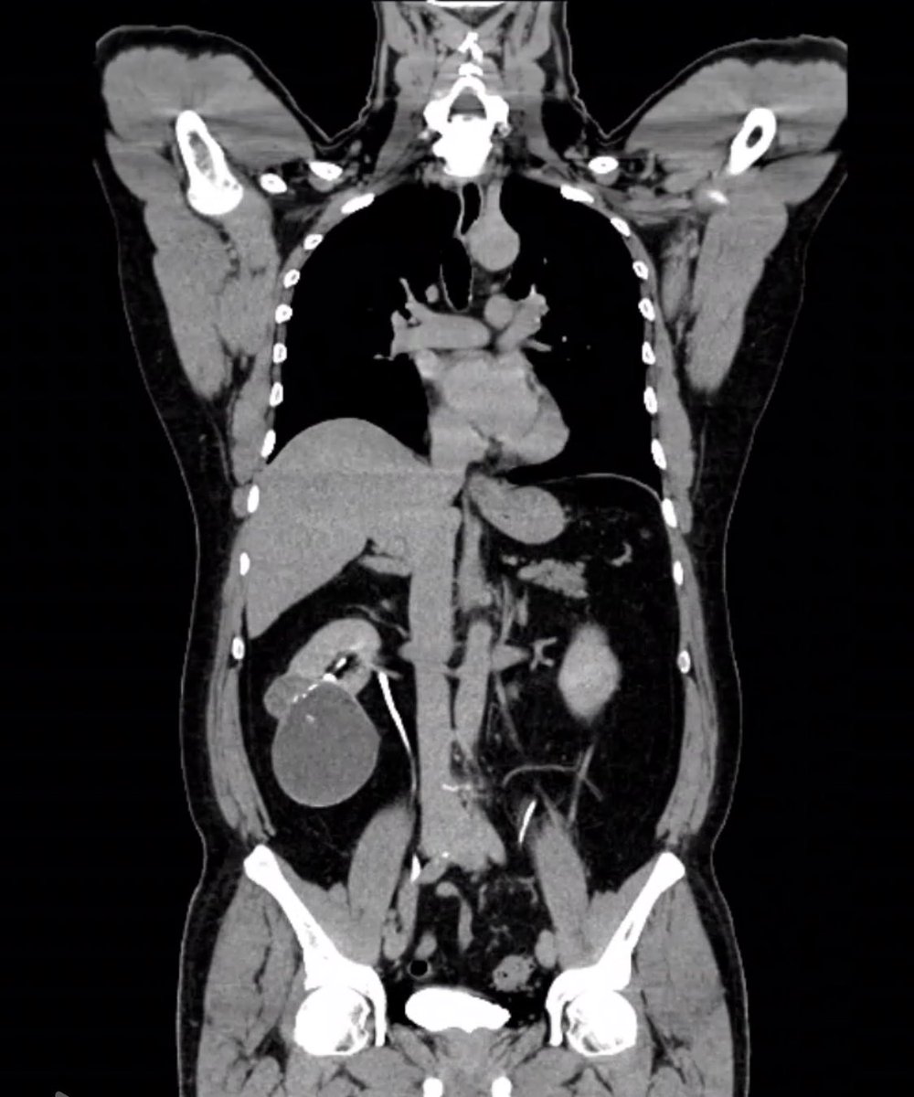 dr_blas's tweet photo. Impulsar la cirugía de mínima invasión en su formación es clave para ofrecer atención de excelencia y mantenernos a la vanguardia en Urología. @HgeSonora https://t.co/YYG42Hspyo