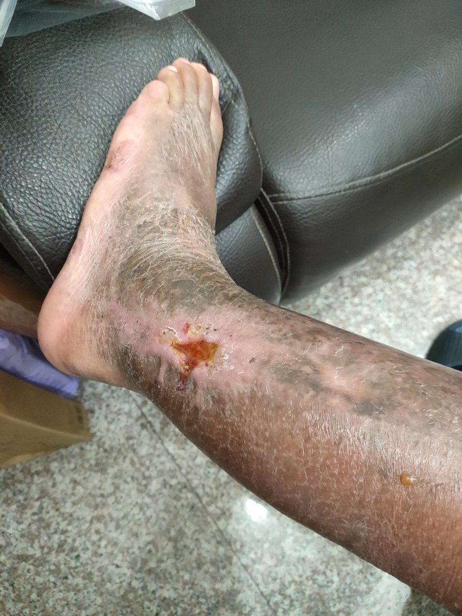 Accidie Chen (@accidiechen) on Twitter photo 