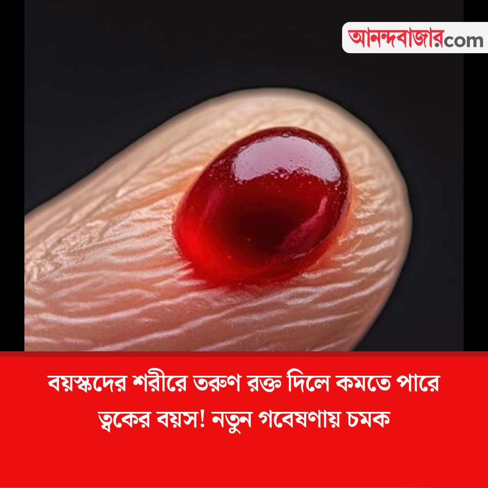 MyAnandaBazar's tweet photo. রক্তে লুকিয়ে তারুণ্যের চাবিকাঠি!
#blood #antiaging #skincells #sciencenews
https://t.co/CkzFHovvqe https://t.co/NpoZcj2mez