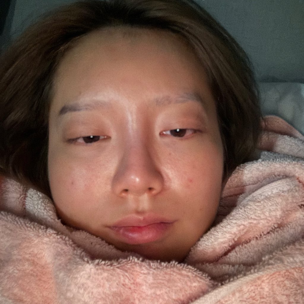 ETH $4400                             ETH $4400
4days ago                                NOW