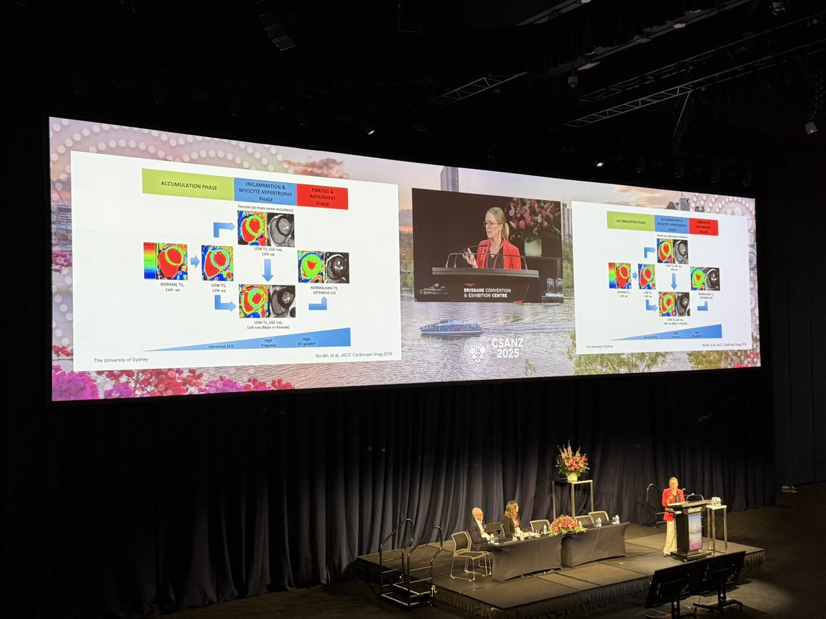 Fabry disease as an inflammatory cardiomyopathy. Masterclass by <a href="/rebeccakozor/">Rebecca Kozor</a> in the big room at #CSANZ2025