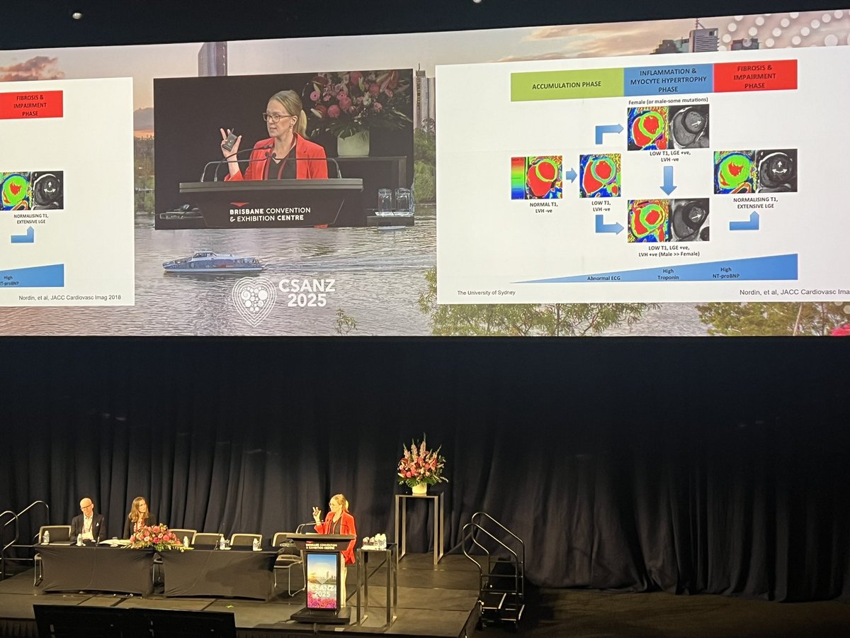 <a href="/rebeccakozor/">Rebecca Kozor</a> masterclass in Fabry’s disease and understanding the subtleties in the diagnosis unlocked by CMR #CSANZ 2025. <a href="/SCMRorg/">Society for Cardiovascular Magnetic Resonance</a> <a href="/thecsanz/">CSANZ</a>