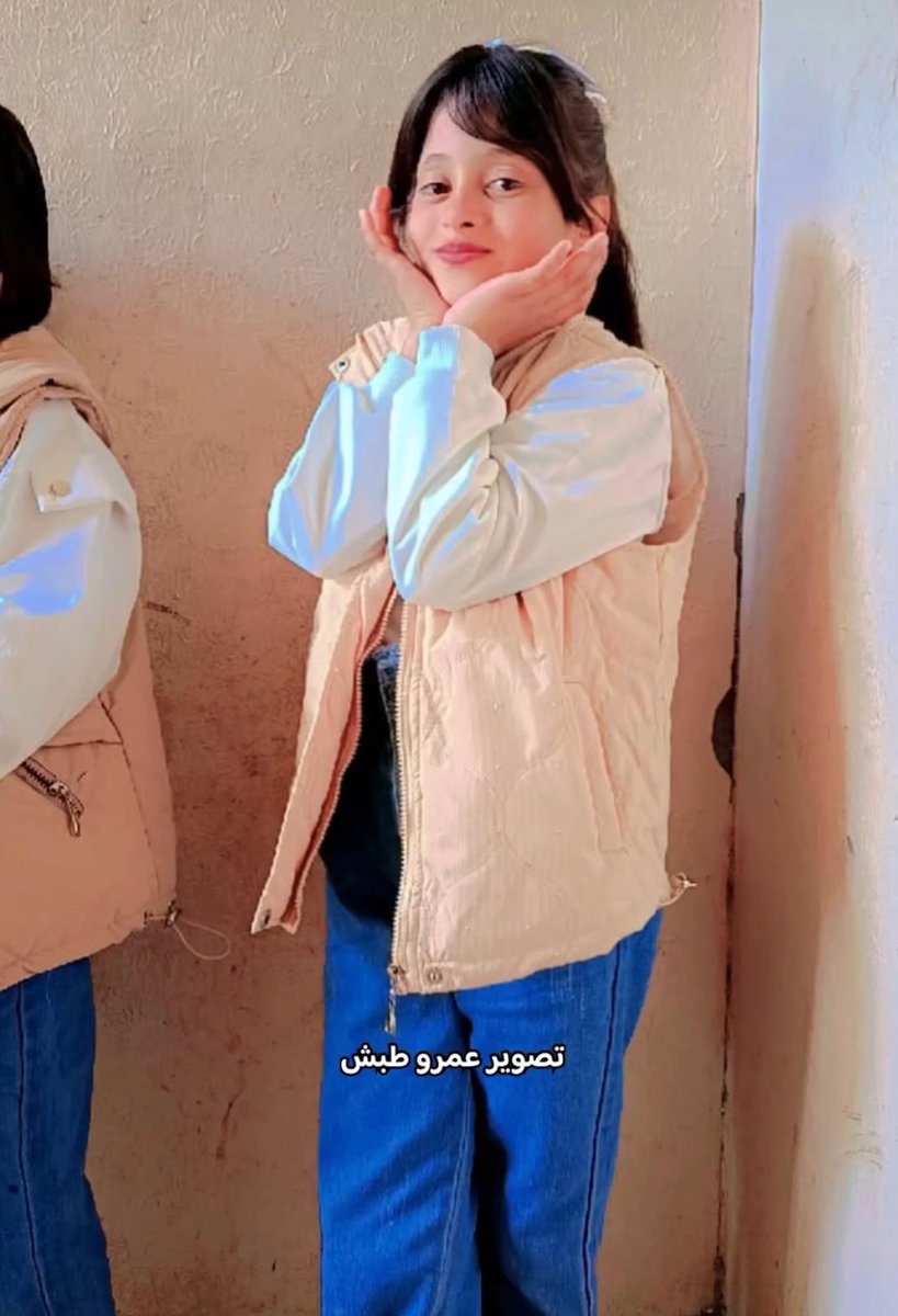 🚨Heartbreaking: 12 year old Mariam Ibrahim suffered a severe head injury in an Israeli airstrike on Khan Younis southern Gaza, shrapnel pierced her brain, fracturing her skull.