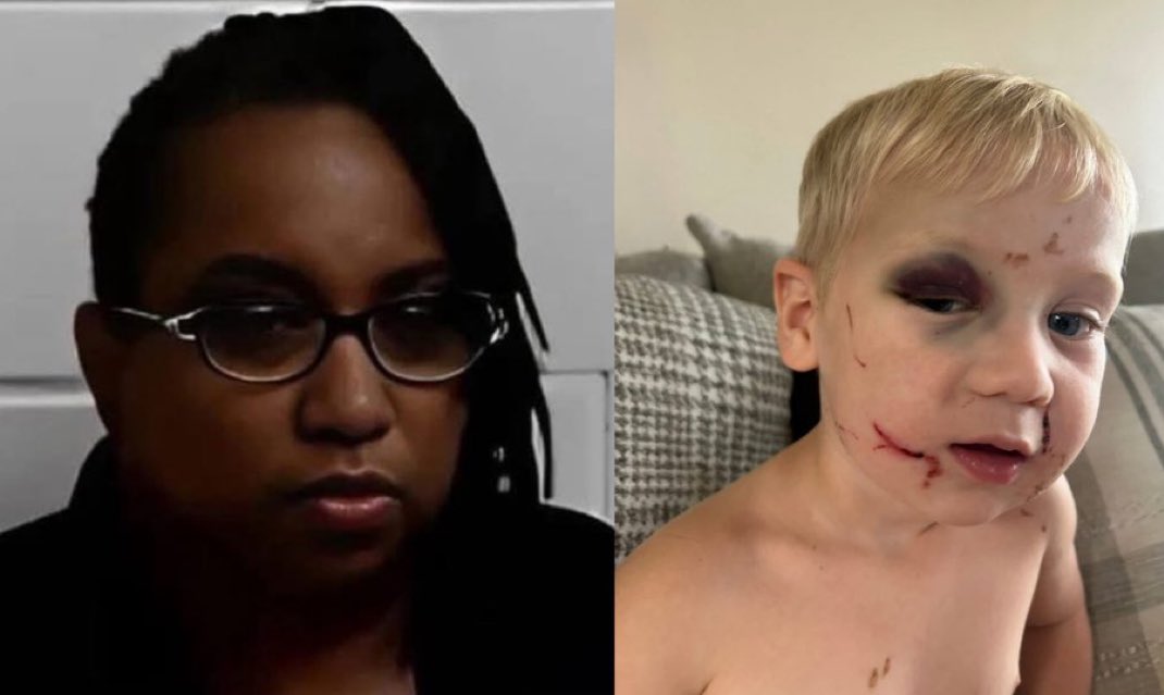 Don’t let her get away with it!  Make her infamous. Yvette Thurston, 54, punched this baby in the face repeatedly at Little Blessing Child Care in Bainbridge GA. Staff lied-blamed the child. Cameras told the truth. She bonded out. No bail for abuser!