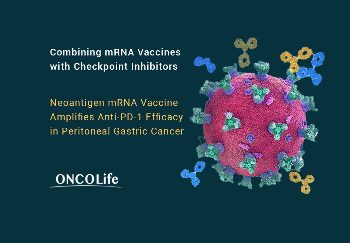 A novel #mRNA-based vaccine encoding #tumor-specific neoantigens significantly enhanced anti-PD1 therapy in #gastriccancer with peritoneal metastasis. In preclinical models, the vaccine alone prevented metastasis and when combined with #antiPD1 eradicated
healthandpharma.net/mrna-vaccines-…