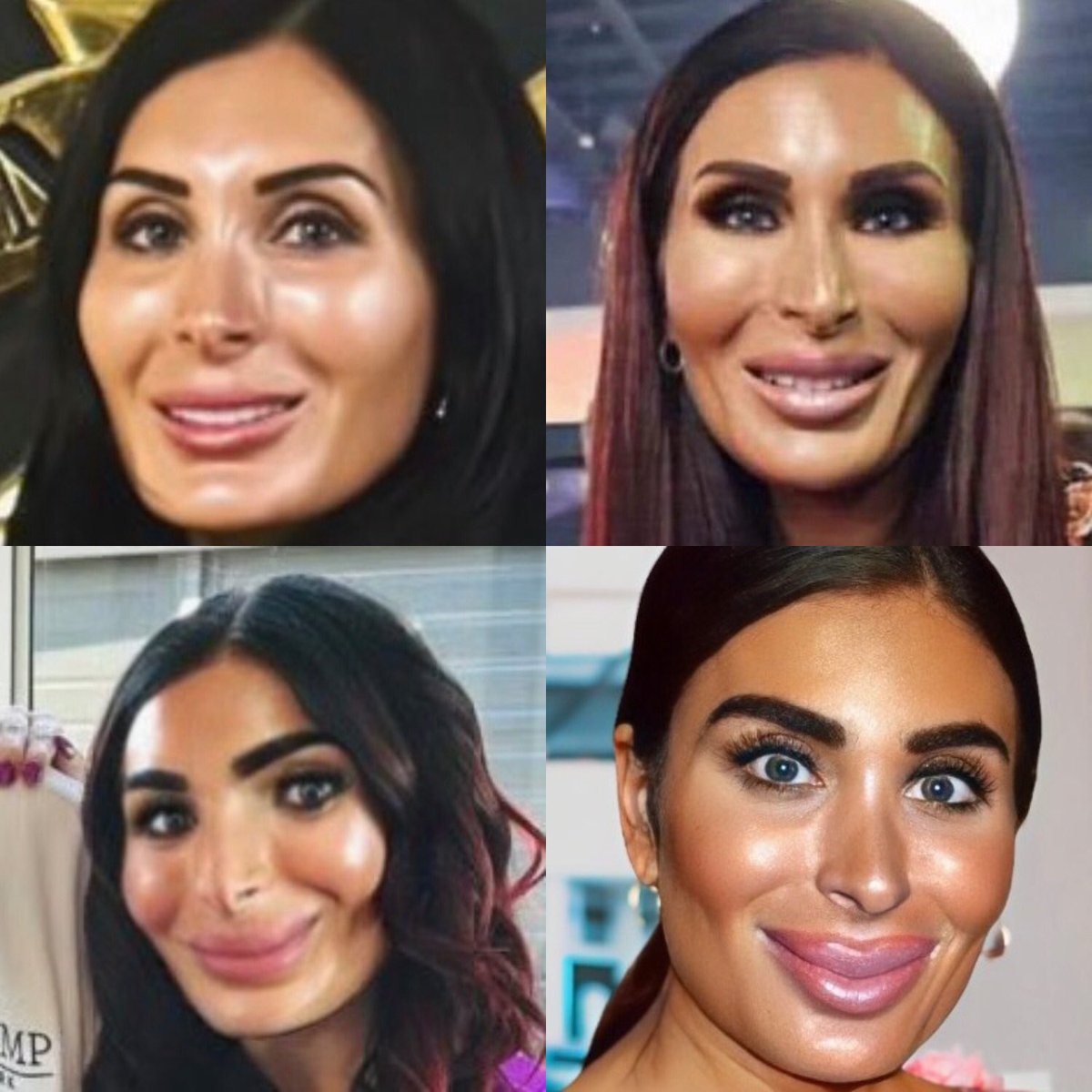 I was this many years old when I found out Laura Loomer has the worst plastic surgeons in the world