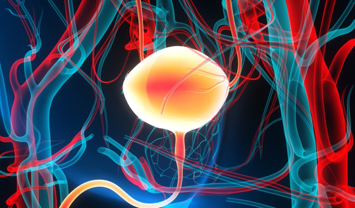 Oncology Times (@oncologytimes) on Twitter photo Studies show that approximately 50% of high-risk non–muscle-invasive #BladderCancer patients experience disease recurrence after bacillus Calmette-Guérin. Keep reading: ow.ly/pHO250WGGG4 Studies show that approximately 50% of high-risk non–muscle-invasive #BladderCancer patients experience disease recurrence after bacillus Calmette-Guérin. Keep reading: ow.ly/pHO250WGGG4