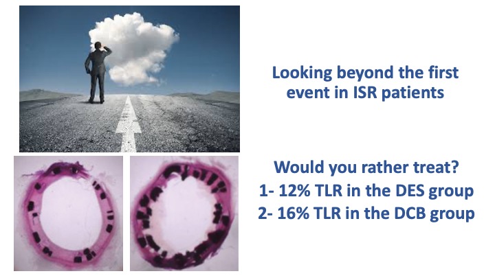 Michael Megaly (@michaelmegalymd) on Twitter photo During the last <a href="/cvinnovations/">CV Innovations</a> I had the pleasure to speak of DCB in ISR use,
With the ESC guidelines giving a class I indication of DES over DCB in ISR, given the solid data showing superiority, I raised the discussion that it is not a one-size-fits-all situation.
Of course, During the last <a href="/cvinnovations/">CV Innovations</a> I had the pleasure to speak of DCB in ISR use,
With the ESC guidelines giving a class I indication of DES over DCB in ISR, given the solid data showing superiority, I raised the discussion that it is not a one-size-fits-all situation.
Of course,