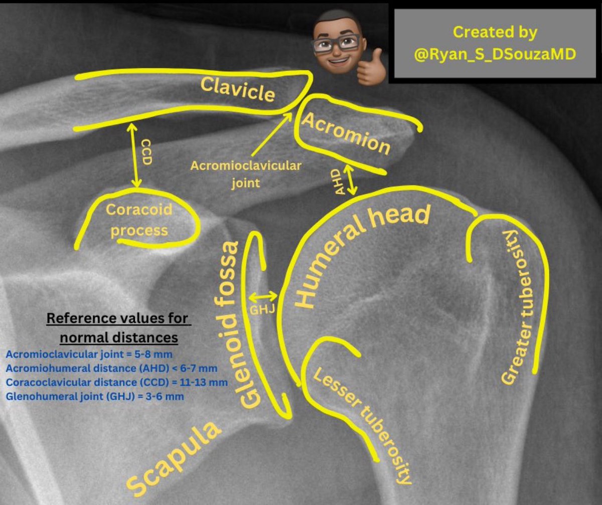 Shoulder x-ray landmarks📌