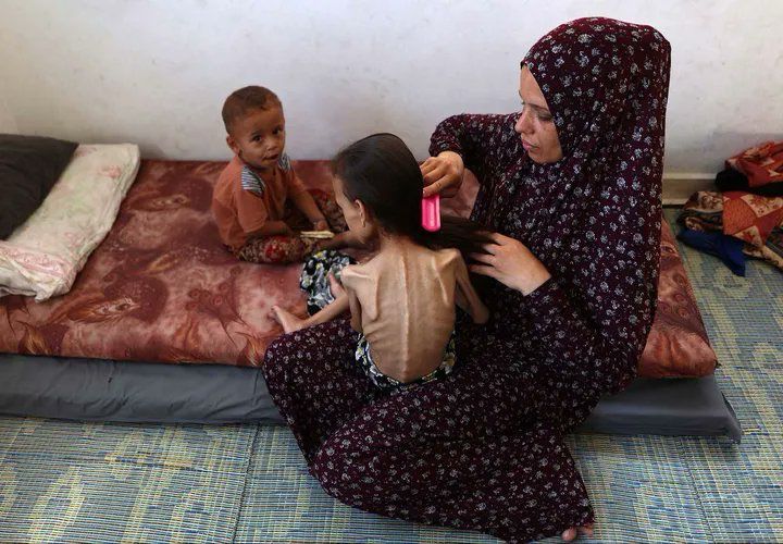David Collier (@mishtal) on Twitter photo <a href="/SkyNews/">Sky News</a> <a href="/DiMagnaySky/">Diana Magnay</a> You've gone from telling us there are no operational hospitals - to telling us all the hospitals are overwhelmed. These children have underlying health issues. Tragic yes - but no a sign of famine. And they all have healthy siblings. JUST STOP LYING!
x.com/SkyNews/statusโฆ <a href="/SkyNews/">Sky News</a> <a href="/DiMagnaySky/">Diana Magnay</a> You've gone from telling us there are no operational hospitals - to telling us all the hospitals are overwhelmed. These children have underlying health issues. Tragic yes - but no a sign of famine. And they all have healthy siblings. JUST STOP LYING!
x.com/SkyNews/statusโฆ