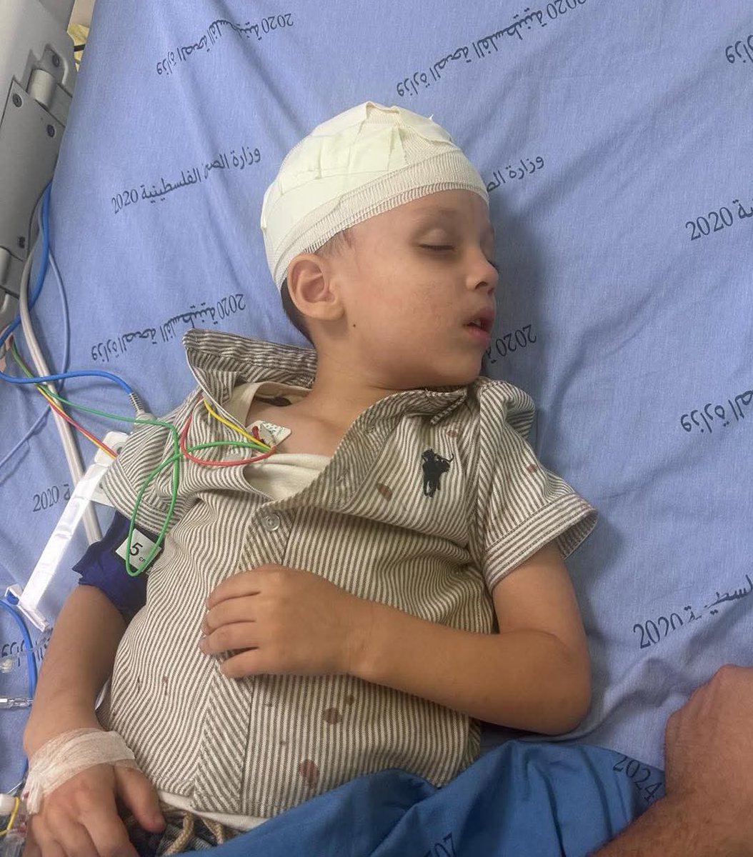 Horrific: 5-year-old Palestinian child Jude Bassam Shalabi was injured after Israeli settlers attacked him and his family near Nablus in the West Bank.

He was rushed to the hospital and is suffering from a skull injury.