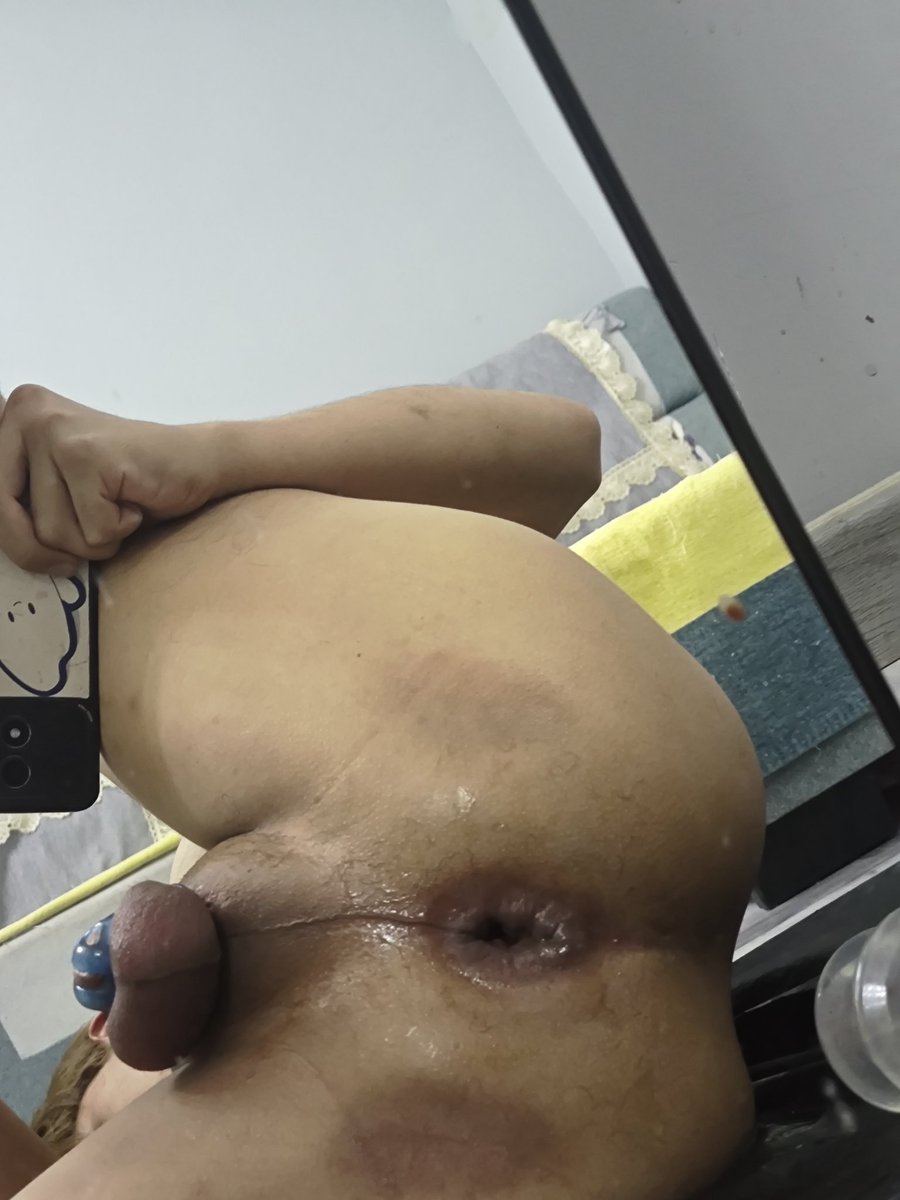 Sodomimx's tweet photo. 没人玩骚逼 骚逼就自己玩
#自拳 #拳交 #扩肛 #外翻 https://t.co/6M9cod3mXa