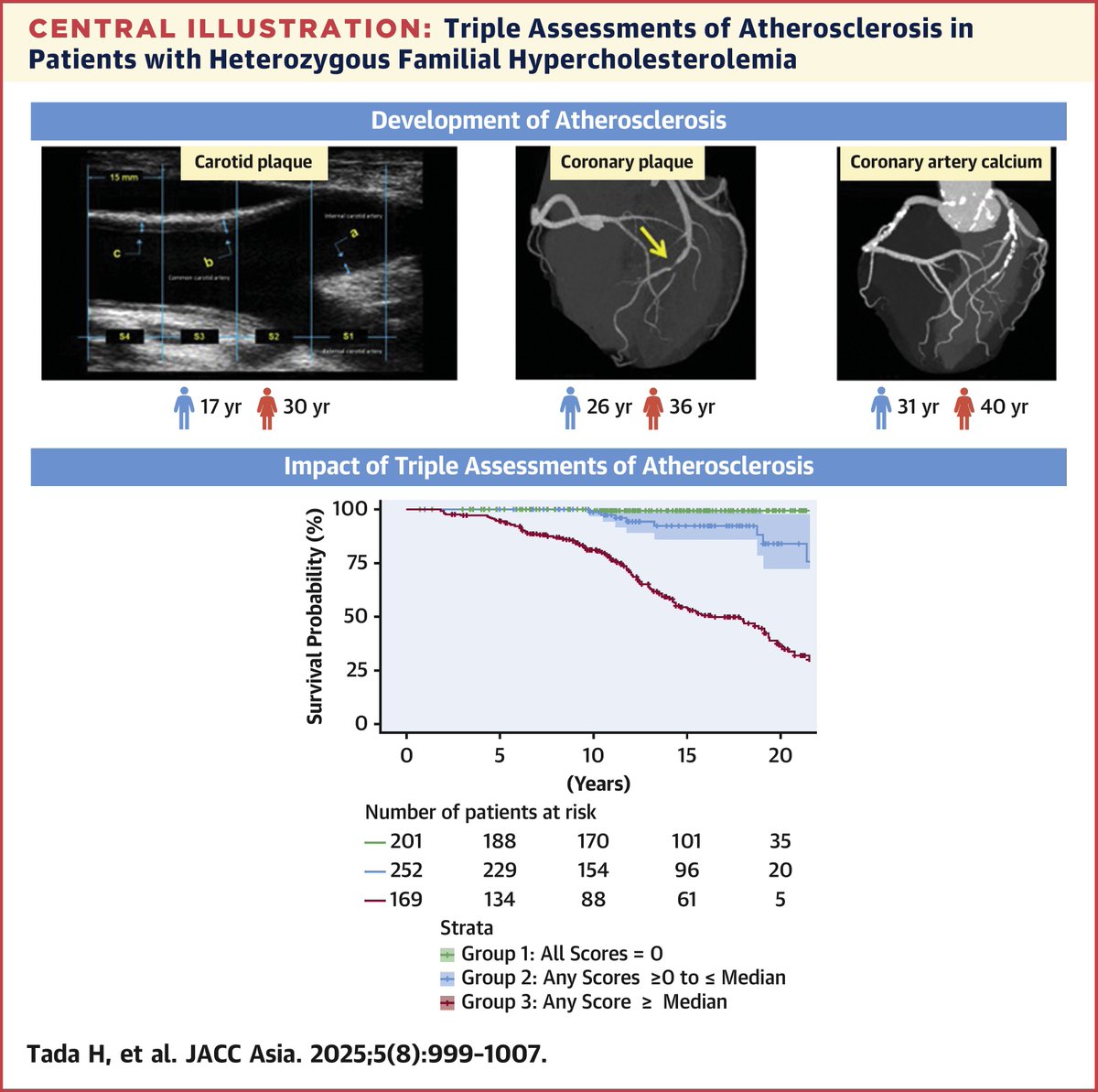🫀 In familial hypercholesterolemia (HeFH), artery changes start young—carotid plaque at 17♂ / 30♀, coronary plaque at 26♂ / 36♀. Triple checks 🩻 (carotid, coronary, CAC) improve risk stratification &amp; prevention 💪 Full study 👉 jacc.org/doi/10.1016/j.…  #JACCAsia #cvPrev