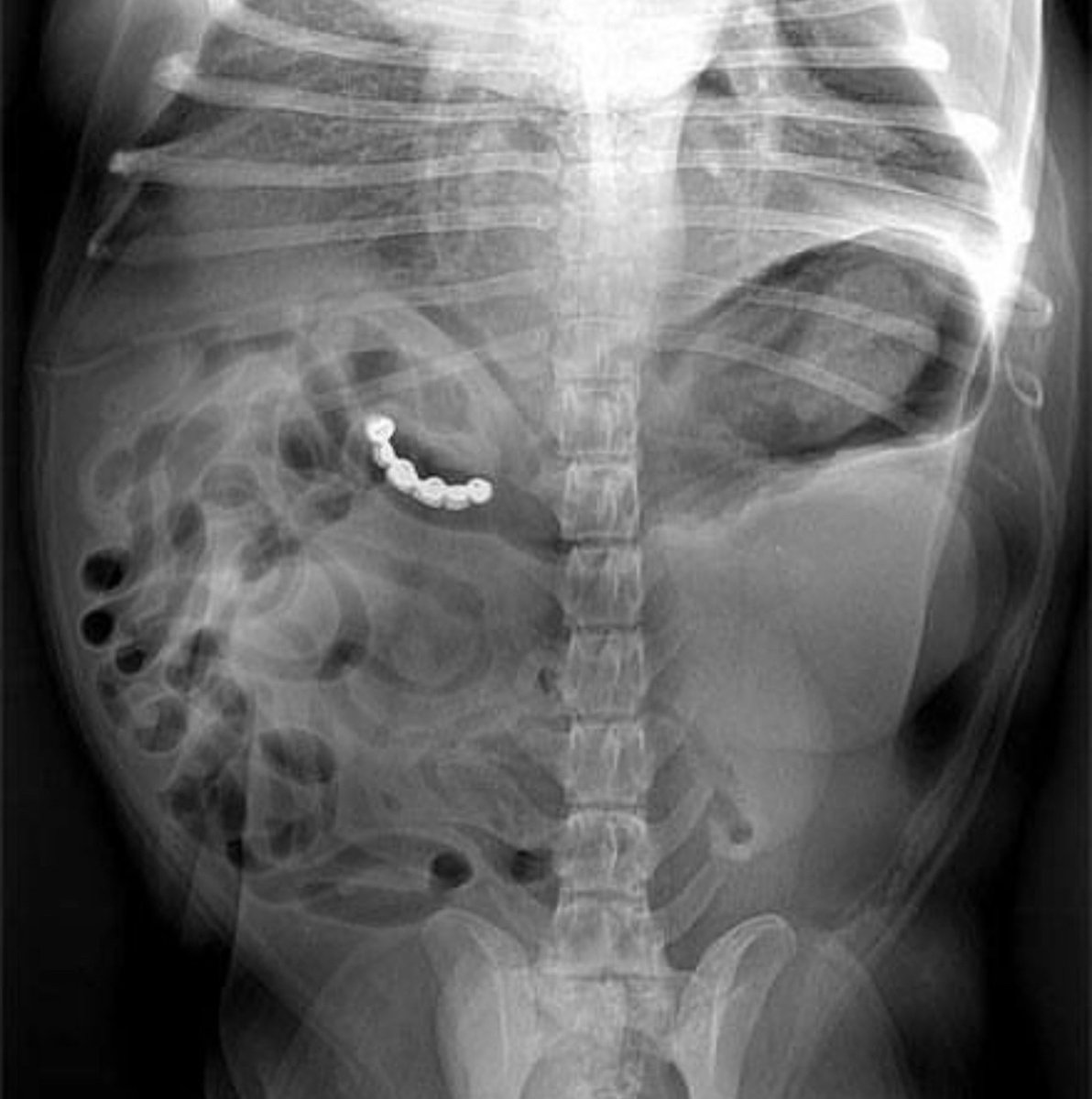 Keith Siau tweet media