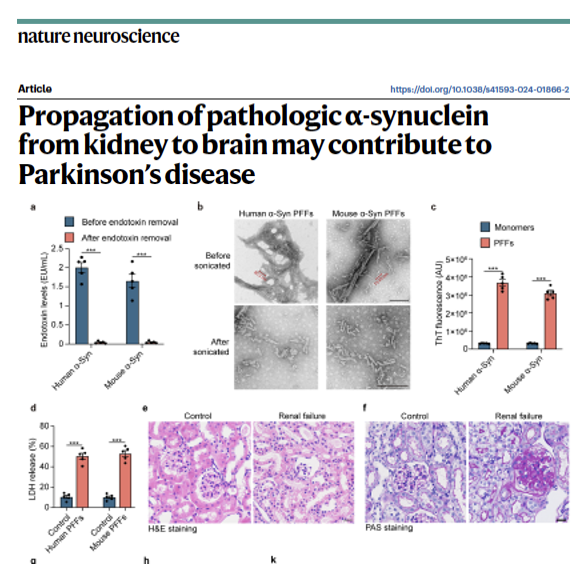 MichaelOkun's tweet photo. Does Parkinson's start in the kidney? New research from Wuhan recently published in Nature Neuroscience suggests a surprising twist: the kidneys, in some cases, may seed toxic α-synuclein and the protein may actually travel to the brain. Could a kidney-to-brain pathway could help explain why chronic kidney disease raises Parkinson’s risk. Let's not go too far on this data yet.
Key Points:
- We’ve long known about gut to brain spread and now the kidney emerges as another possible origin site.
- These findings may unlock new strategies for early detection and therapies aimed at clearing α-synuclein before it reaches the brain.
- Pathologic α-synuclein deposits were found in the kidneys of folks w/ Parkinson’s disease, dementia with Lewy bodies, and chronic kidney disease.
- In animal models, α-synuclein injected into the kidney spread along renal nerve pathways into the brain.
- It also resulted in PD-like motor symptoms.
My take: Parkinson's is a whole body disease and the proteins can thus be found all over. These findings do not surprise me, however I would be cautious about over-interpreting them. Here are 5 points that stuck w/ me. 1- Parkinson’s may not start in the brain, in some cases the kidney could be a surprising origin site for the disease. 2- Toxic Parkinson’s proteins can build up in the kidney, especially when kidney function is impaired. 3- Proteins may travel along nerve highways directly to the brain. 4- Does this paper explain why people w/ kidney disease face higher risks of developing Parkinson’s? Maybe? 5- Could we target α-synuclein in the blood or kidney? Maybe?
https://t.co/C3xjJLPZrS @ParkinsonDotOrg #parkinson @FixelInstitute @Nature