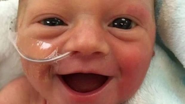 Little Freya was the baby with the Million Dollar Smile.

She was born 6 weeks early. And her Mom Lauren took the amazing photo.

“I was talking to her and I said, ‘Should we send a picture to Daddy?’ And right when I was about to take the picture, she had this huge smile."
