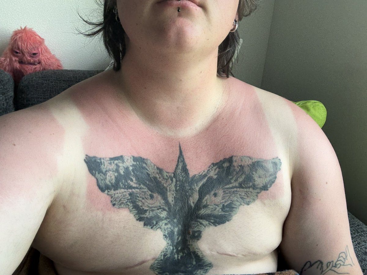 KXResGod's tweet photo. Guys I got a little burnt at ren faire who wants to rub aloe on me https://t.co/874VbCWj6Z