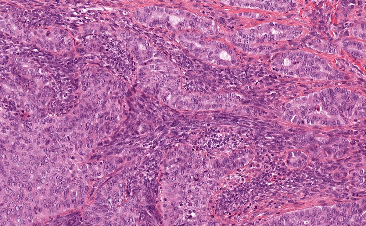 Toby Schmitt, MD tweet media