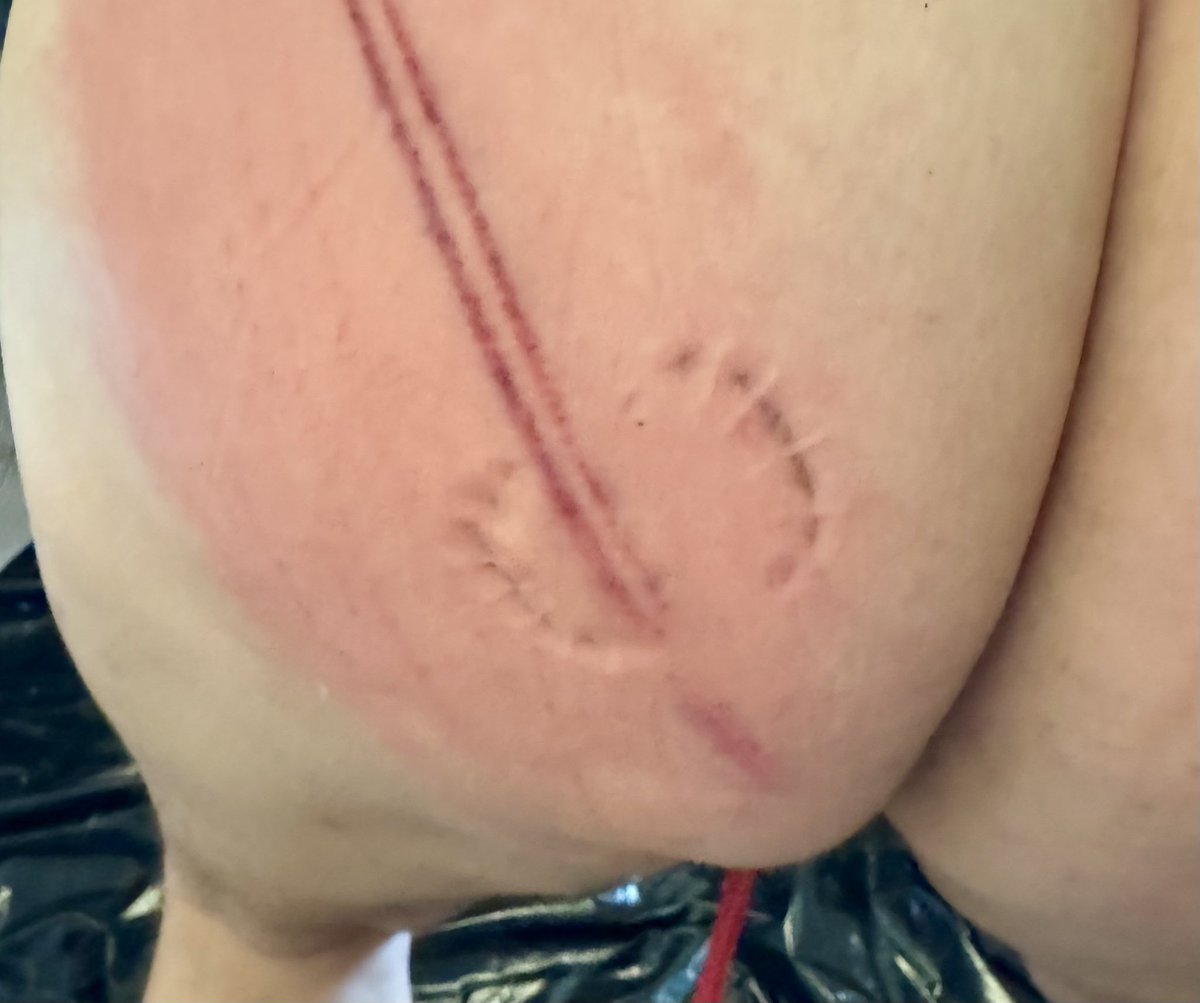 SIR Flavio has often bitten into tut and my nipples. This time he also bit my ass.

SIR thank you SIR

#gayslave #ownedslave #gaymaster #gaytorture #gaysm #gaypain #gaycbt #tinydick #tinycock #tinyballs #uselessdick  #uselesscock #uselessballs