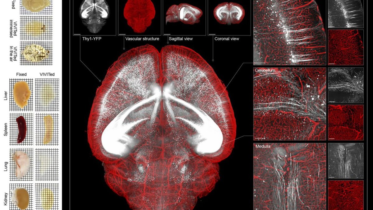intl_source's tweet image. #China #Neuroscience #BrainTechnology
Chinese scientists have unveiled a groundbreaking &quot;transparent brain&quot; technology, offering an unprecedented view of the brain&apos;s inner workings and opening new fro...
intlsource.net/en/public/arti…