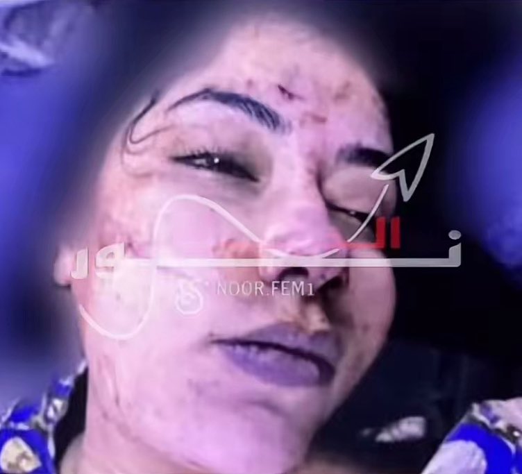 511vl0's tweet photo. هاذا من غير الكدمات الي موجوده ب رقبتها ووجها مثل مو شايفين بالصوره كلشي واضح انه عملية قتل والبيت هو مسرح الجريمة وبخصوص ام بان لو فعلياً ما تدري عن شي ومتأثره كان ماقدرت تجاوب عن الصحافه وبكل طلاقه لسان ولو تشوفون الفديو حقها كانت تكلج وواضح تعرف عن كلشي وطالبة بالتحقيق https://t.co/s6ebFXVNaq