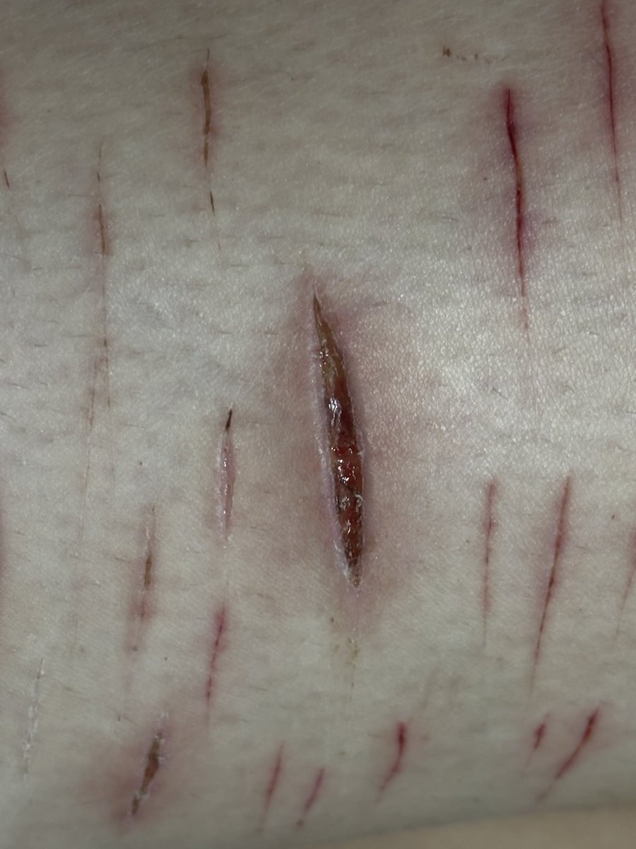 hey guys is this infected