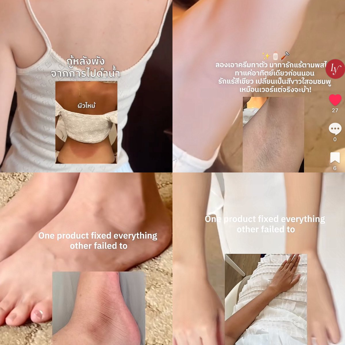 คนสวยขาต้องการสิ่งนี้! สกินแคร์สำหรับผิวกาย
ที่ทาแค่ตัวเดียวลูบไปจบปัญหาได้เลยทุกจุด

เลอม่าเป็นบูสเตอร์บอดี้เซรั่ม ที่มีสารwhiteningที่มีคุณภาพ และใส่สารสกัดมาในปริมาณที่จะเห็นผลชัดหลังใช้ต่อเนื่อง และยังมีเปอร์เซ็นต์ความเข้มข้นสูงแต่ปลอดภัยกับผิว ขาวแบบไม่กัดผิว ไม่กินผิวให้บาง