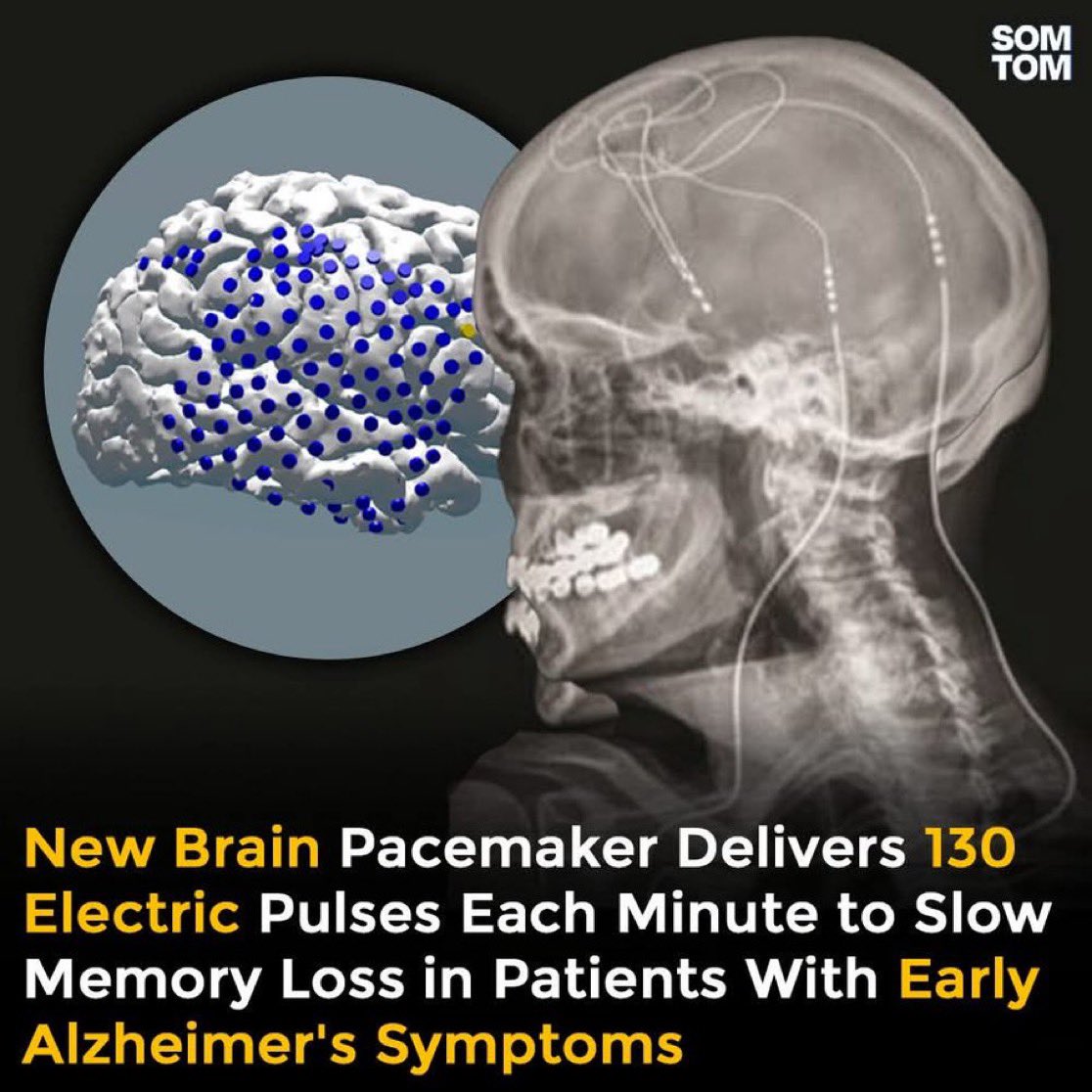 ÇapaMag tweet media