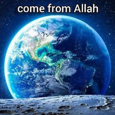 After years of hair loss, Muhammad Qasim is now regaining hair naturally, stunning many observers. #TransformasiQasim