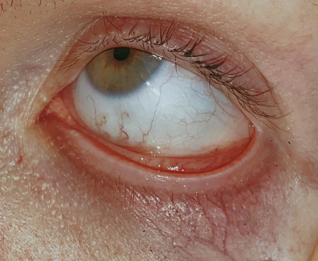 &gt;&gt; I rheyhwrheyhryj