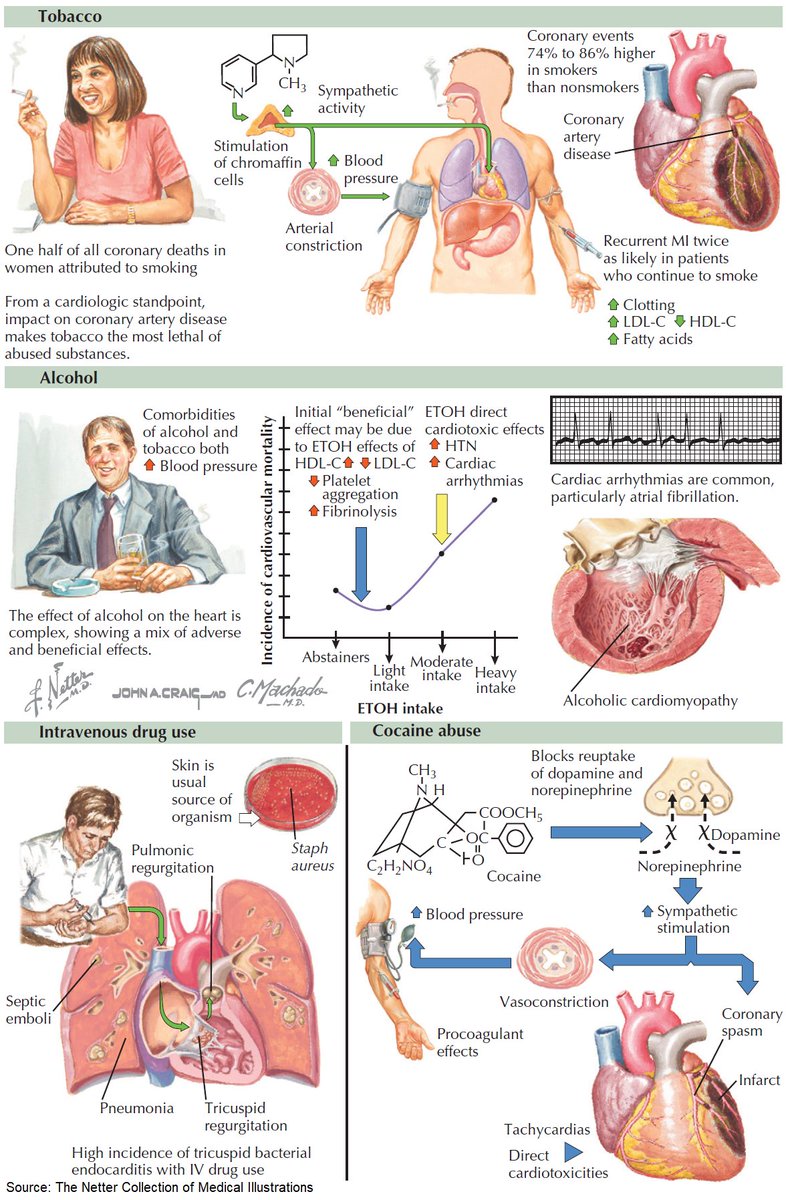 Substance Abuse and The Heart

#medtwitter #foamed #cardioed