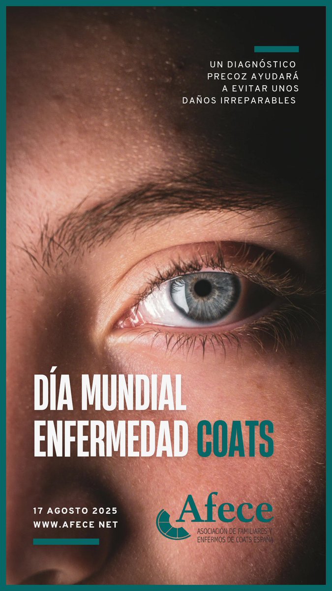 Hoy es el día internacional de la Enfermedad de Coats. Una enfermedad rara que afecta de manera grave a la visión de sus afectados. 
Hoy queremos recordar que un diagnóstico precoz ayudará a evitar daños irreparables 
#enfermedaddecoats #coatsdisease #coats #enfermedadrara