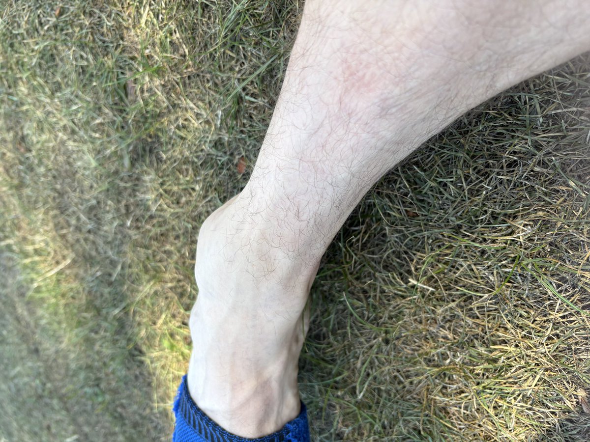Ankle looking well