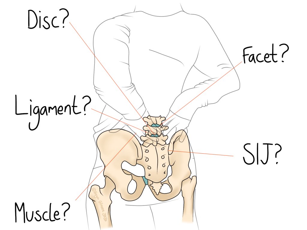 Nawaf_Nhar's tweet photo. ألم أسفل الظهر غير المحدد المزمن
(Chronic Non-Specific Low Back Pain)

واحدة من أكثر الحالات شيوعًا، واللي تسبب إزعاج كبير للمرضى… لكن وش معناها بالضبط؟ وليش نسمّيها “غير محدد”؟

خلنا نفصّل 👇 https://t.co/LDv6YX8niC