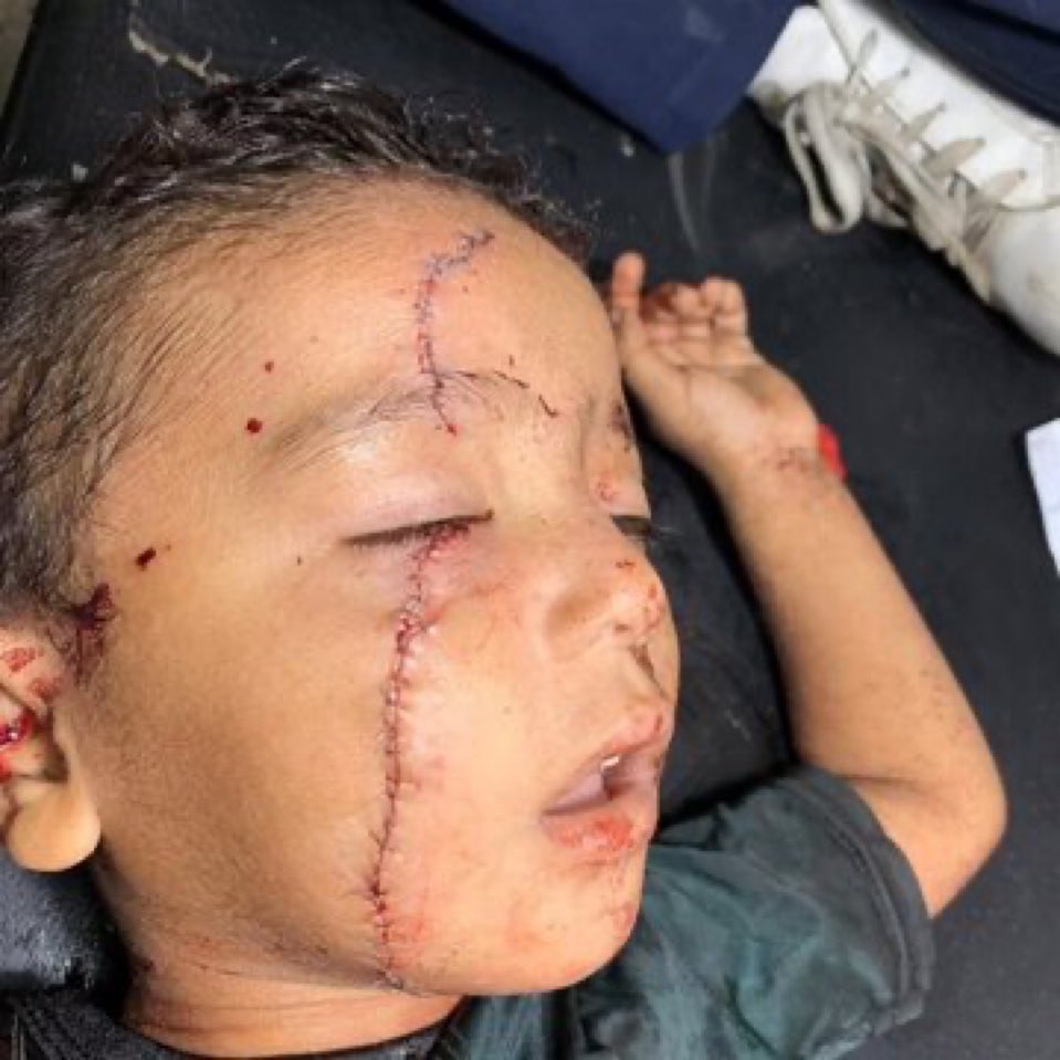 هذا ما فعلته اسرائيل بأطفال غزة بسلاح امريكي