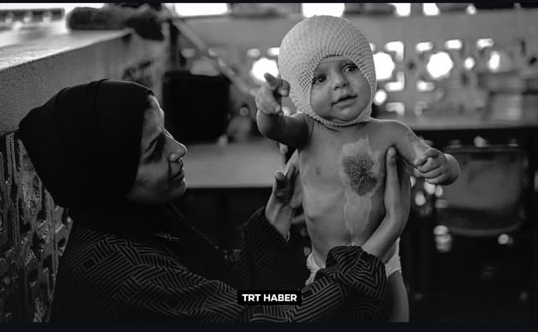 halilguzel2702's tweet photo. Soykırımcı İsrailin zulmü gözler önünde çoluk çocuk demeden tüm insanları öldürmeye devam ediyor dur diyemedi onca İslam ülkesi kardeşleri gözlerinin önünde soykırıma uğrarken onlar sadece izliyor #GazzeAçlıktanÖlüyor #GazzeÖlüyor #FilistiniUnutma https://t.co/xq0TpIc8F0