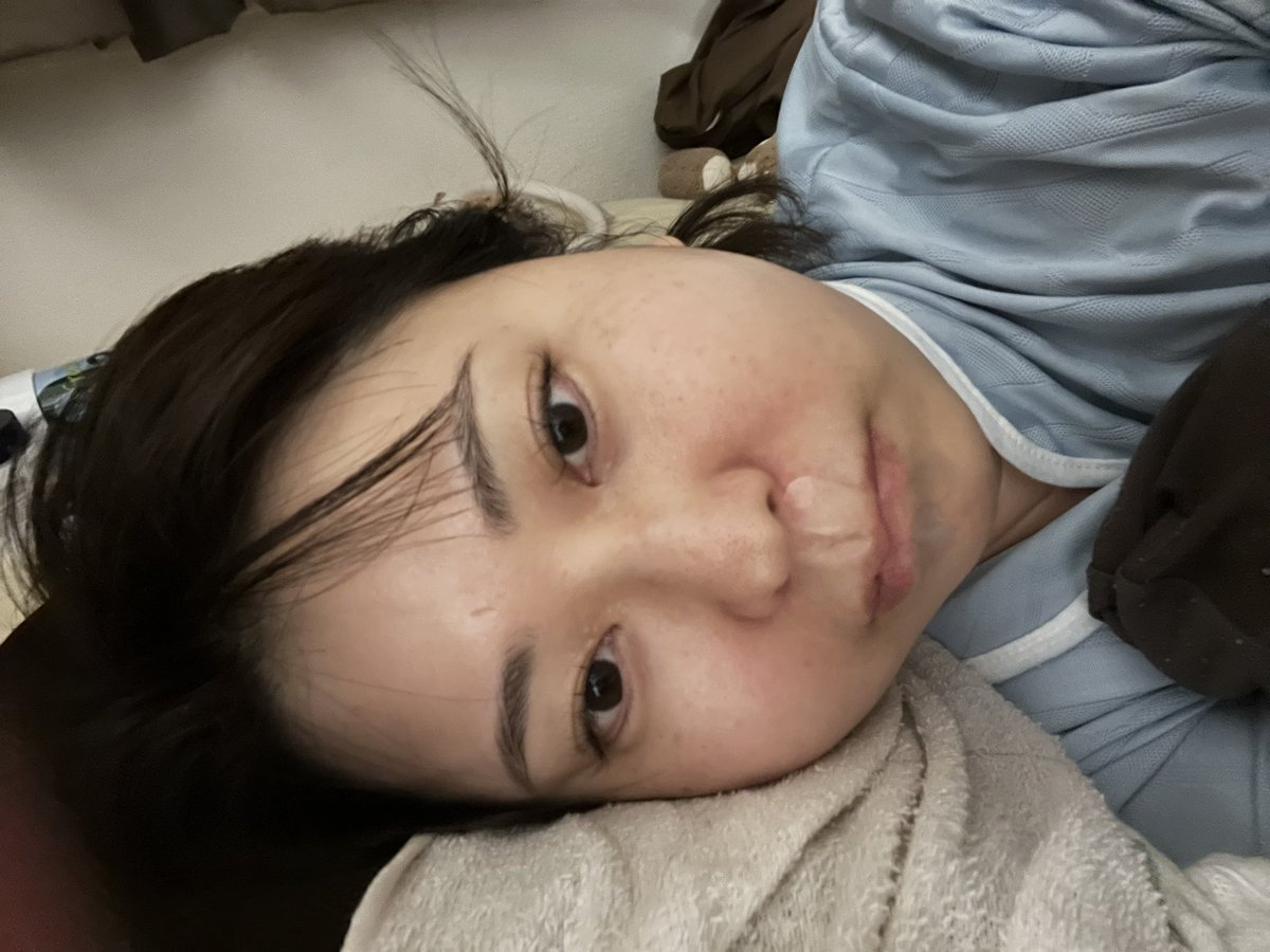 sensushiori0306's tweet image. 睡眠時無呼吸症候群なので、いびき止めテープを試してみることにしました！
#SAS