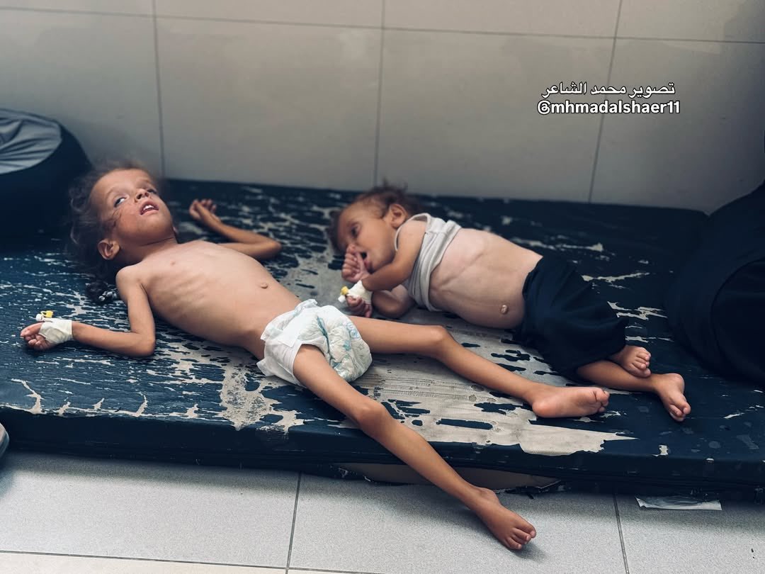 #GazaGenocide‌
17.08.2025