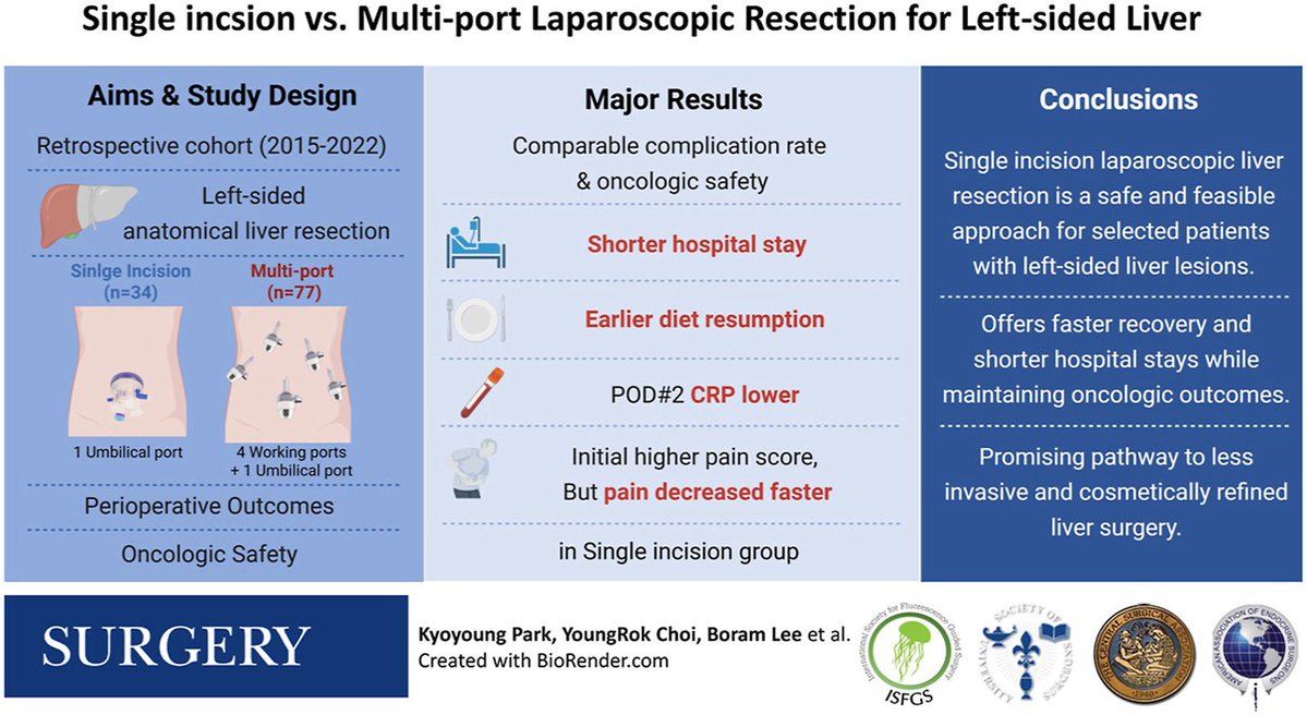 Steven D Wexner MD, PhD (@swexner) on Twitter photo Surgical feasibility for the single-incision laparoscopic left-sided anatomical liver resection: A cohort comparative study - <a href="/SurgJournal/">SURGERY Journal</a> surgjournal.com/article/S0039-… Surgical feasibility for the single-incision laparoscopic left-sided anatomical liver resection: A cohort comparative study - <a href="/SurgJournal/">SURGERY Journal</a> surgjournal.com/article/S0039-…