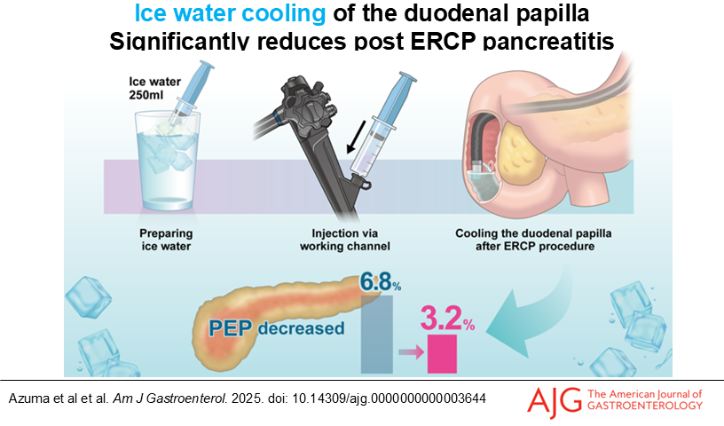 AJG - The American Journal of Gastroenterology (@amjgastro) on Twitter photo Local Post-Procedural Cryoprevention Significantly Reduces the Incidence of Post-ERCP Pancreatitis
Azuma, et al.
📕 doi.org/10.14309/ajg.0…
<a href="/MLongMD/">Millie Long</a> <a href="/JasmohanBajaj/">Jasmohan Bajaj</a> Local Post-Procedural Cryoprevention Significantly Reduces the Incidence of Post-ERCP Pancreatitis
Azuma, et al.
📕 doi.org/10.14309/ajg.0…
<a href="/MLongMD/">Millie Long</a> <a href="/JasmohanBajaj/">Jasmohan Bajaj</a>